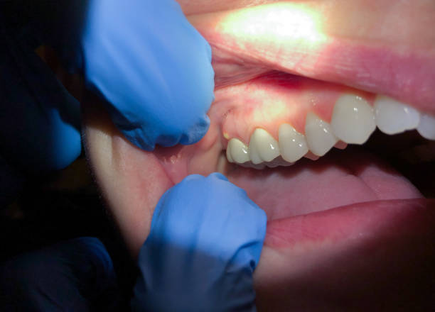 Best Emergency Tooth Extraction  in Nelsonville, OH